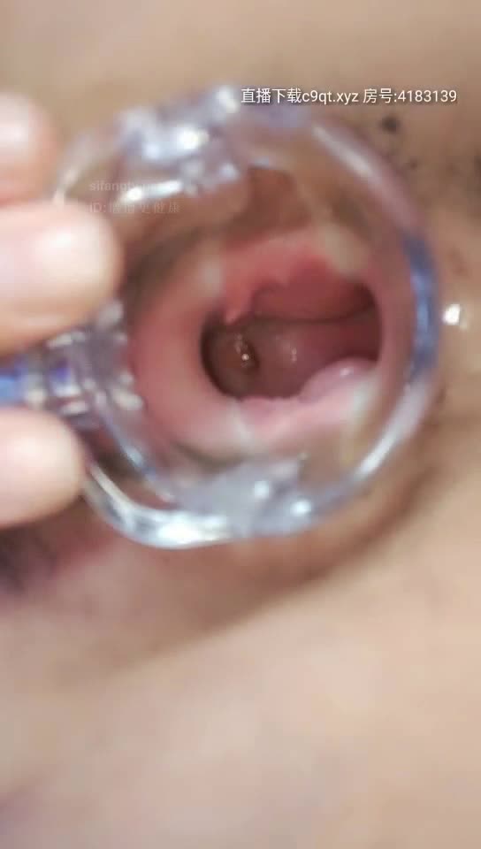 1 (16)