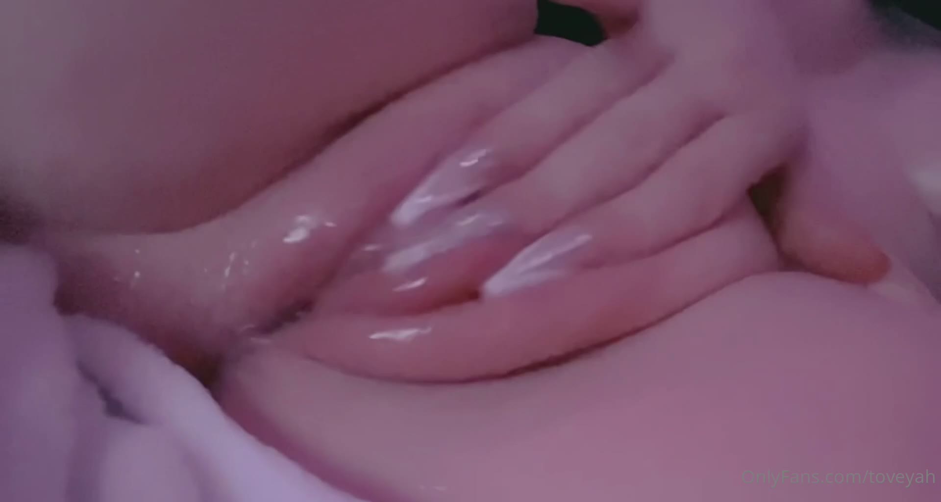  (14)