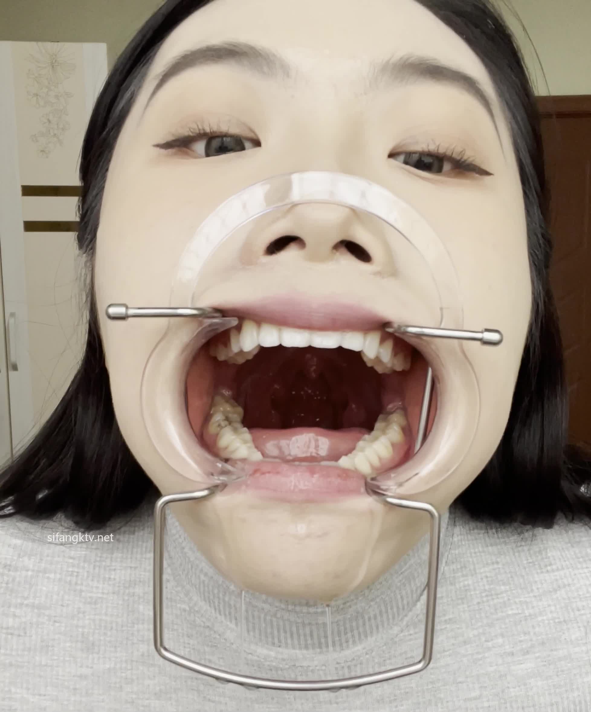 1 (4)